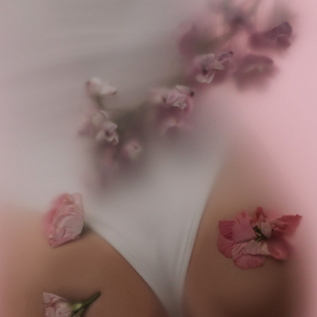 Cellulite Stretch Marks Orange Peel Skin Fat Weight Loss Gain Summer Circulation Skin Care Concerns The Olio Store Online South Africa